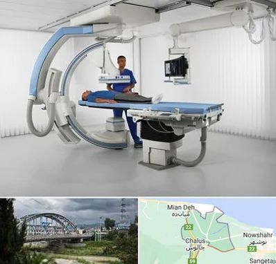 فلوروسکوپی در چالوس