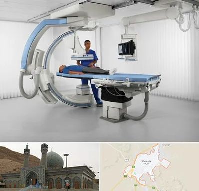 فلوروسکوپی در شهرضا