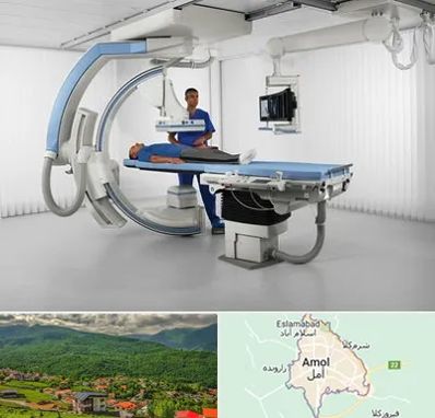 فلوروسکوپی در آمل