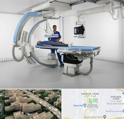 فلوروسکوپی در اکباتان 