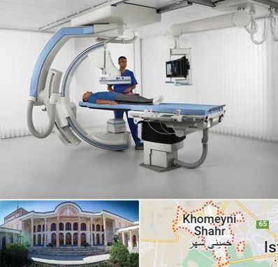 فلوروسکوپی در خمینی شهر