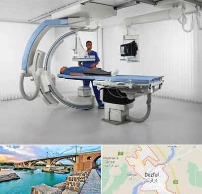 فلوروسکوپی در دزفول