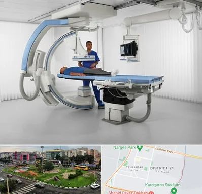 فلوروسکوپی در تهرانسر 