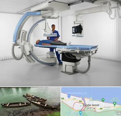 فلوروسکوپی در بندر انزلی