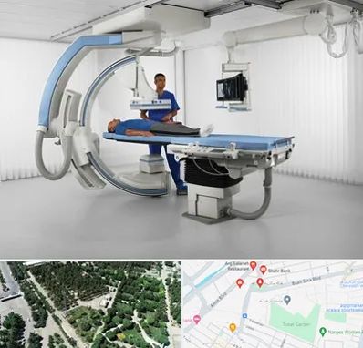 فلوروسکوپی در سالاریه قم