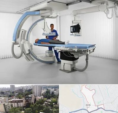 فلوروسکوپی در اوین