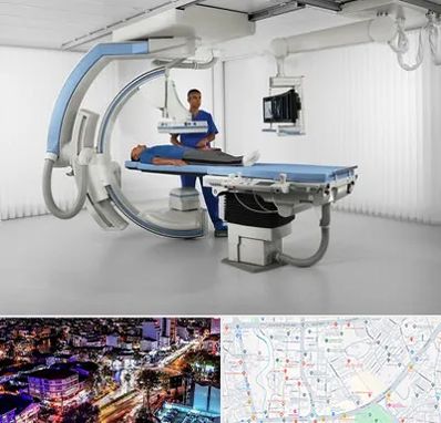 فلوروسکوپی در منظریه رشت