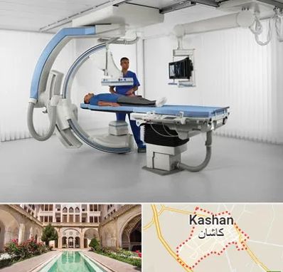 فلوروسکوپی در کاشان