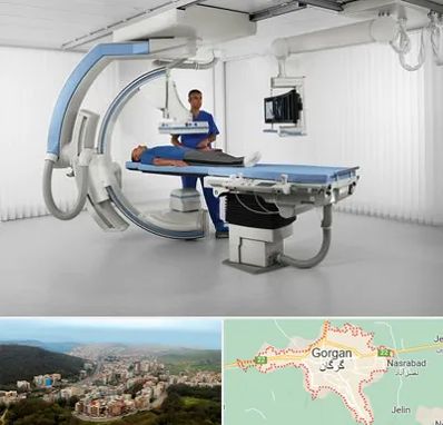 فلوروسکوپی در گرگان