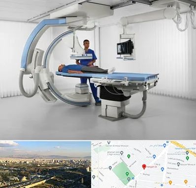 فلوروسکوپی در هنگام