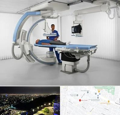 فلوروسکوپی در هفت تیر مشهد