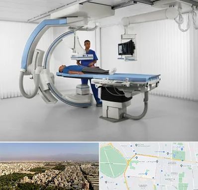 فلوروسکوپی در نازی آباد