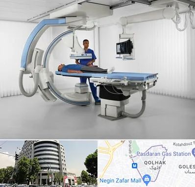 فلوروسکوپی در قلهک 