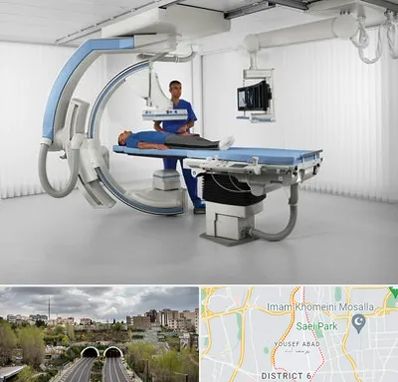 فلوروسکوپی در یوسف آباد 