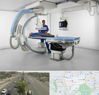 فلوروسکوپی در منطقه 17 تهران