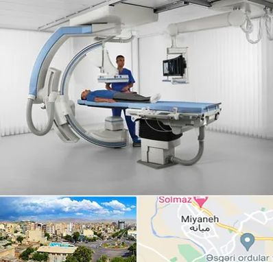 فلوروسکوپی در میانه