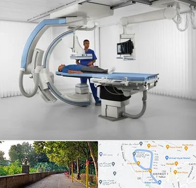 فلوروسکوپی در فلکه گاز رشت