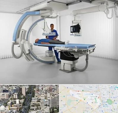فلوروسکوپی در منطقه 18 تهران