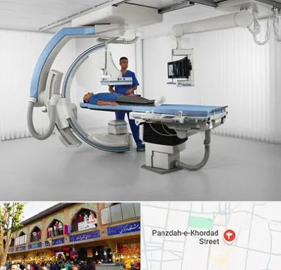 فلوروسکوپی در 15 خرداد