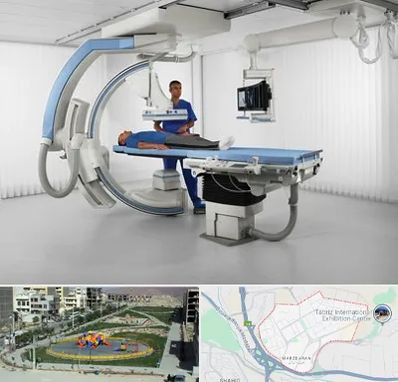 فلوروسکوپی در مرزداران تبریز