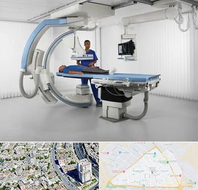 فلوروسکوپی در قاسم آباد مشهد