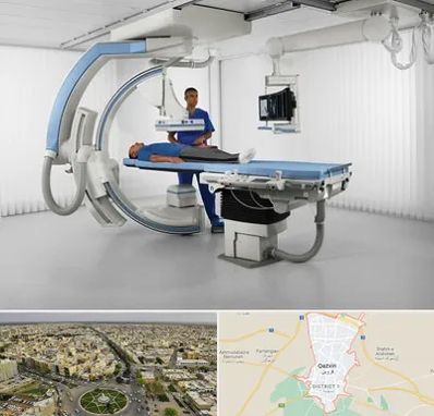 فلوروسکوپی در قزوین