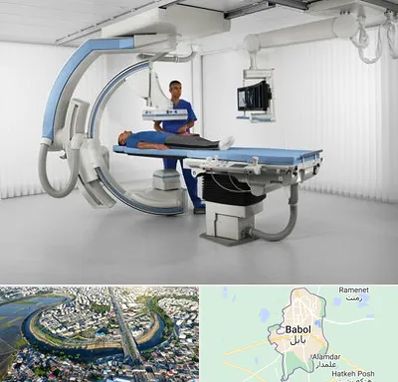 فلوروسکوپی در بابل