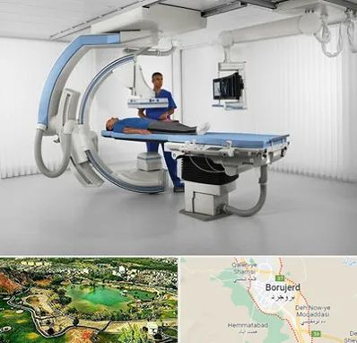 فلوروسکوپی در بروجرد