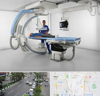 فلوروسکوپی در ستارخان 