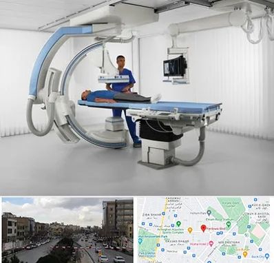 فلوروسکوپی در بلوار فردوسی مشهد