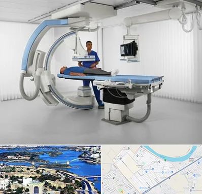 فلوروسکوپی در کوروش اهواز