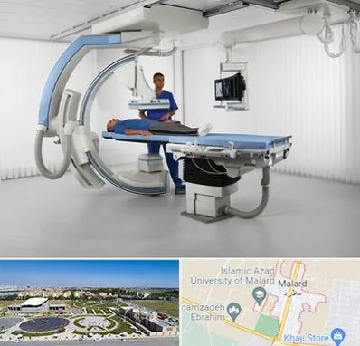 فلوروسکوپی در ملارد