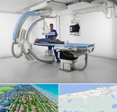 فلوروسکوپی در فریدونکنار