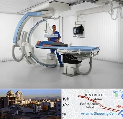 فلوروسکوپی در فرمانیه 
