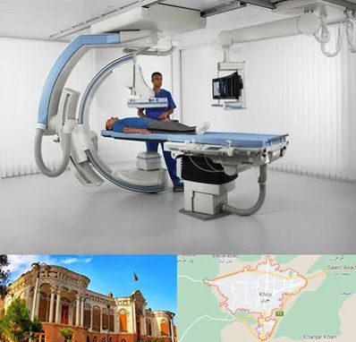 فلوروسکوپی در خوی