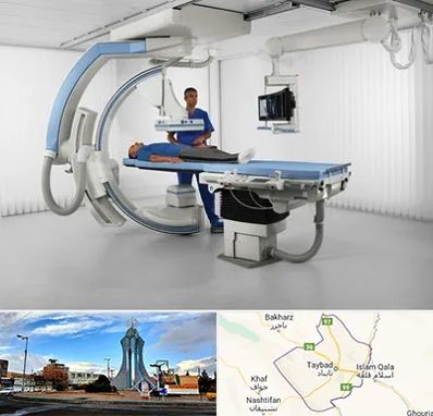 فلوروسکوپی در تایباد