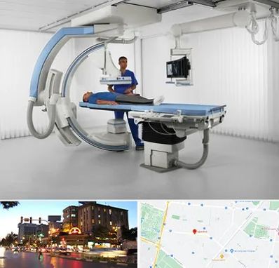 فلوروسکوپی در بلوار سجاد مشهد