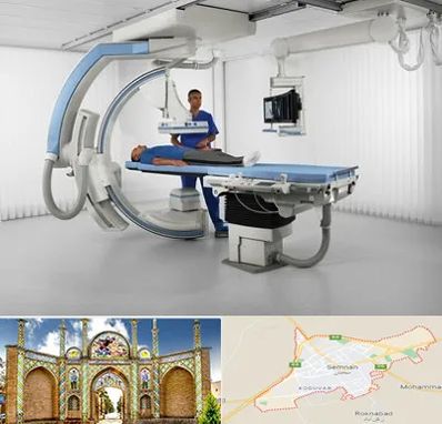 فلوروسکوپی در سمنان