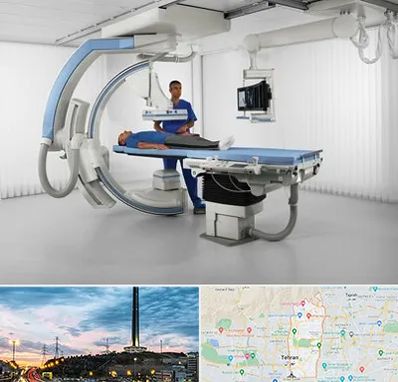 فلوروسکوپی در منطقه 2 تهران