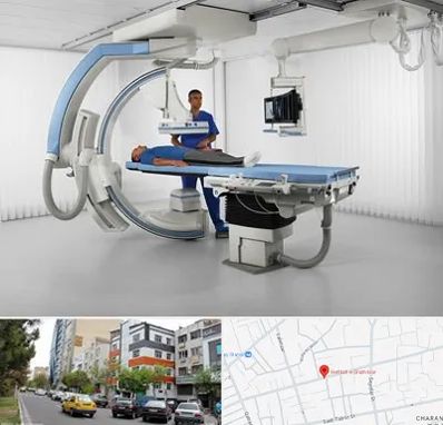 فلوروسکوپی در هفده شهریور تبریز