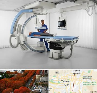 فلوروسکوپی در ولیعصر 