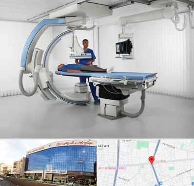 فلوروسکوپی در نصف راه تبریز