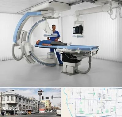فلوروسکوپی در 17شهریور