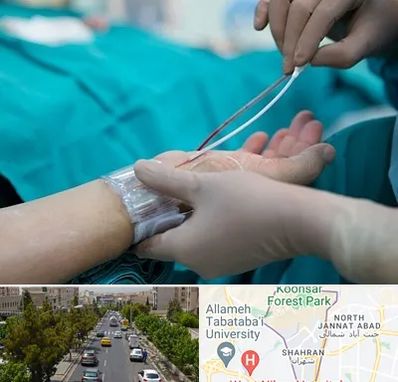 آنژیوگرافی در شهران 