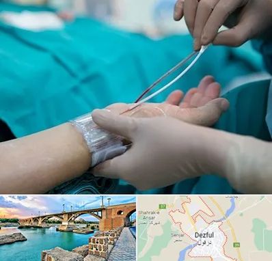 آنژیوگرافی در دزفول