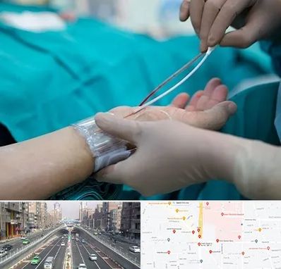 آنژیوگرافی در توحید