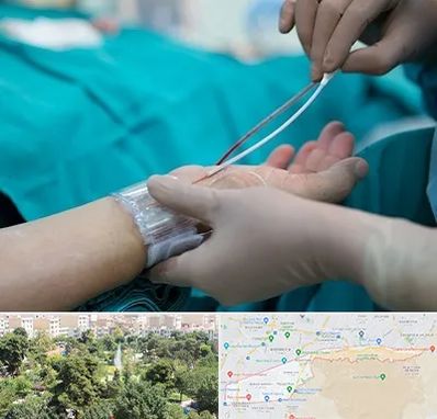 آنژیوگرافی در منطقه 13 تهران