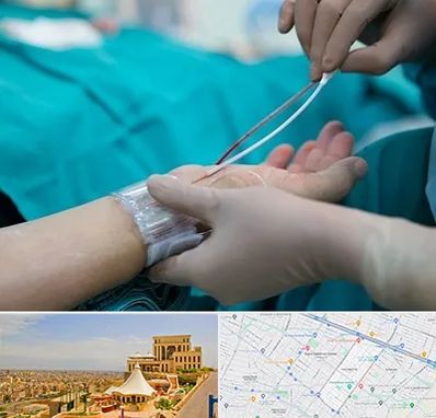 آنژیوگرافی در هاشمیه مشهد