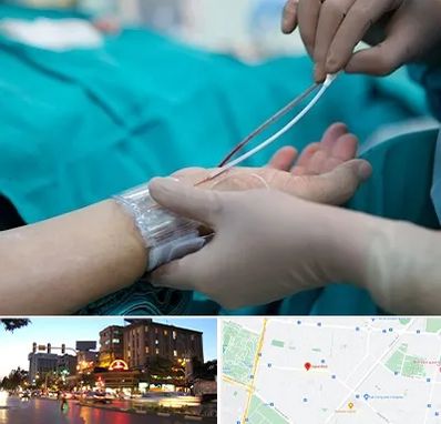 آنژیوگرافی در بلوار سجاد مشهد