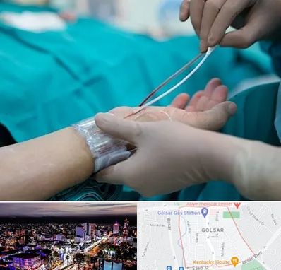 آنژیوگرافی در گلسار رشت 